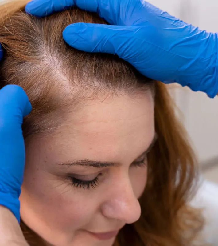 Hair Filler Behandlung