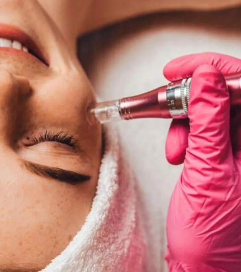 Medizinisches Microneedling