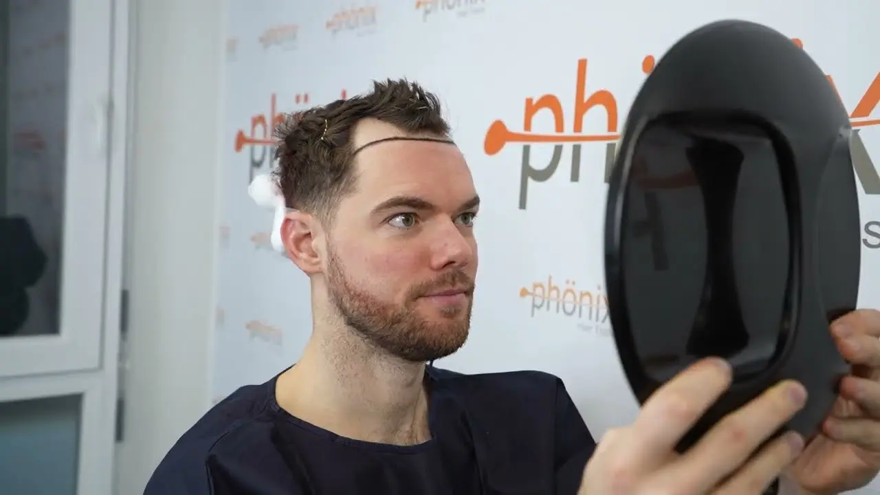 Phönix Hair Trans – Klinikvorstellung & FUE Haartransplantation Dortmund
