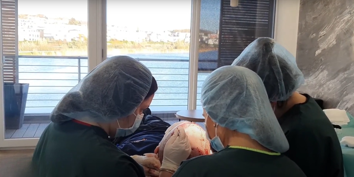 Haarausfall verstehen: Ursachen, Diagnose und moderne Behandlungsansätze