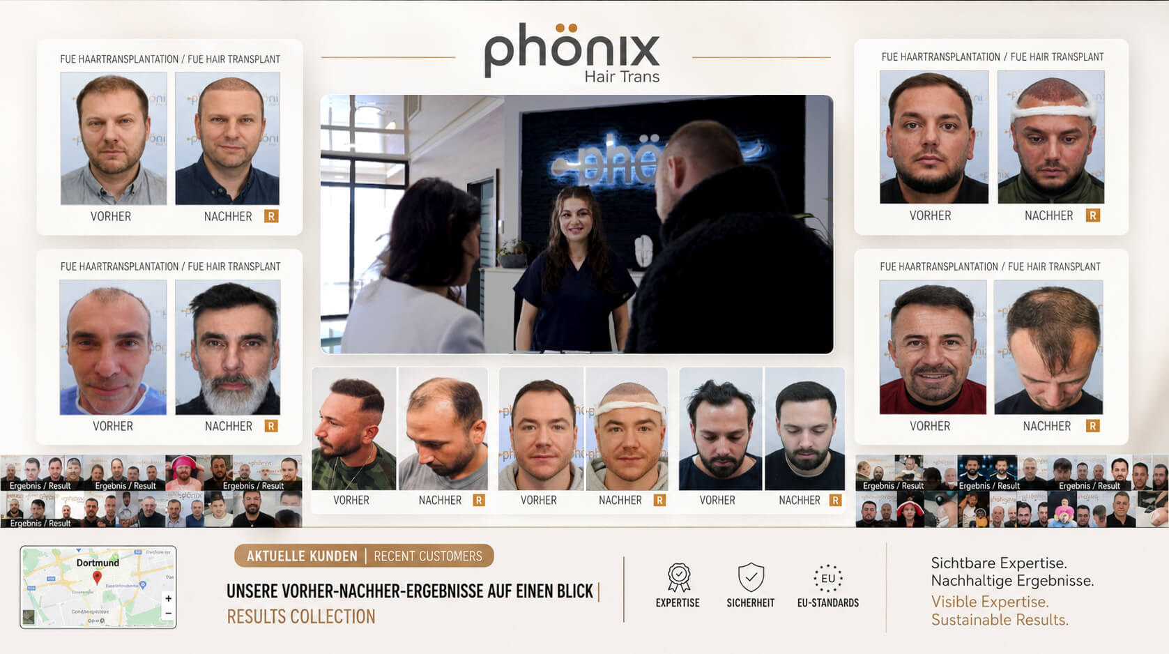 Echte Transformationen aus Dortmund: Vorher-Nachher-Ergebnisse von Phönix Hair Trans