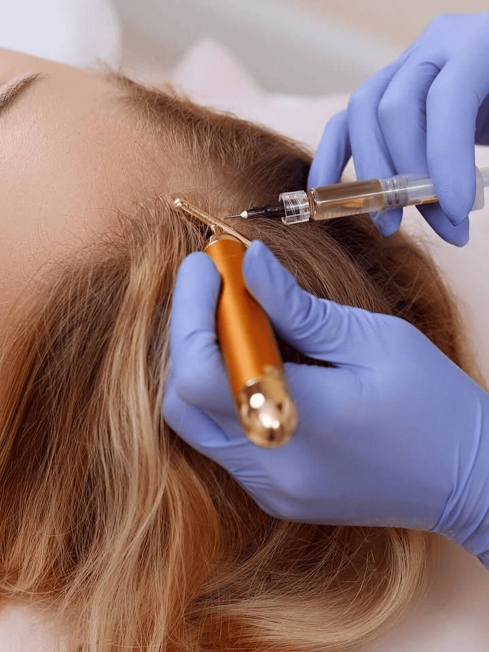 Hairbooster, Mesotherapie